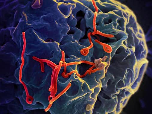 Ébola en París: ¿una amenaza real? 10 Ebola Virus tuescapada.eu