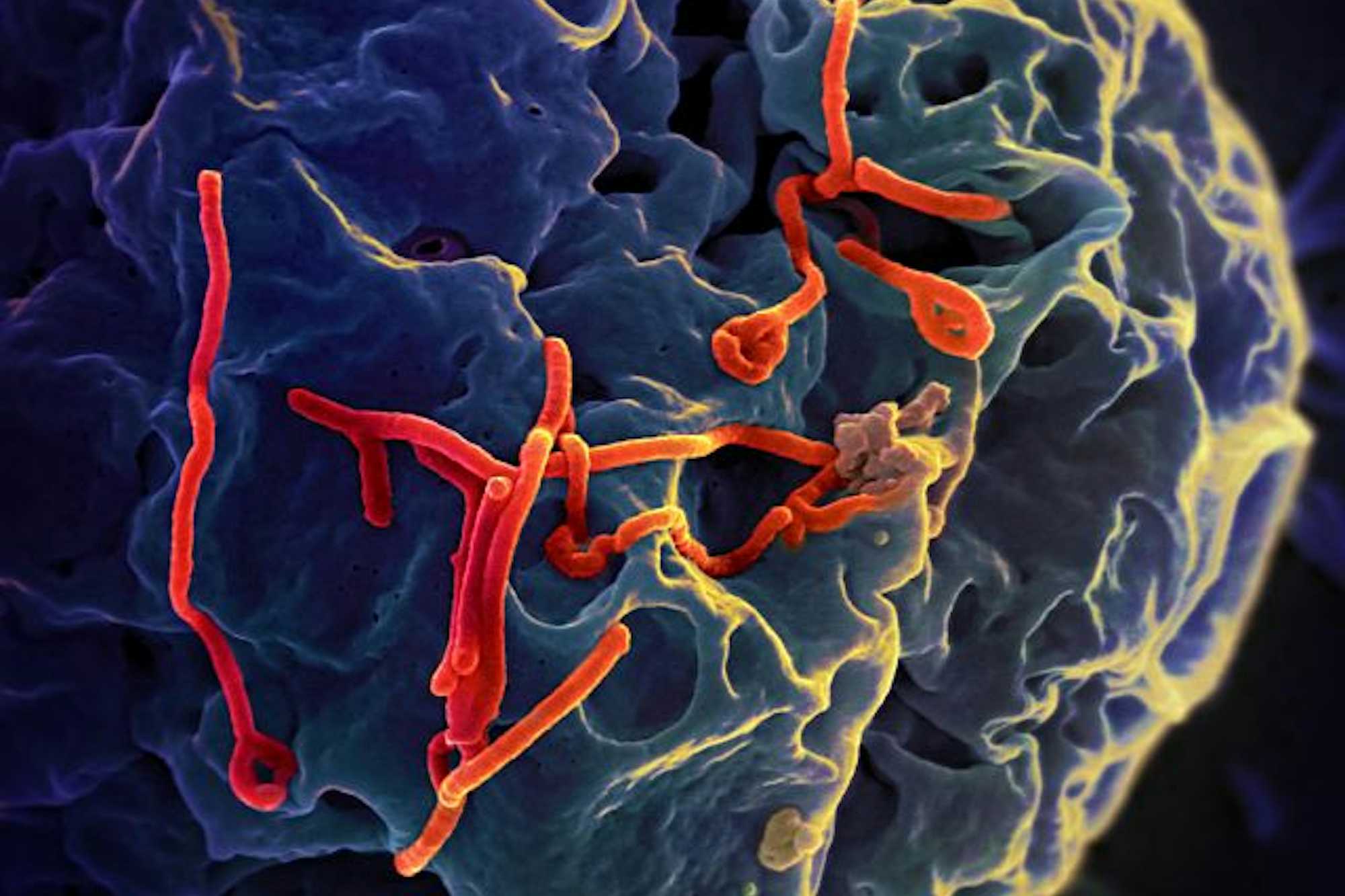 Ebola Virus_tuescapada.eu